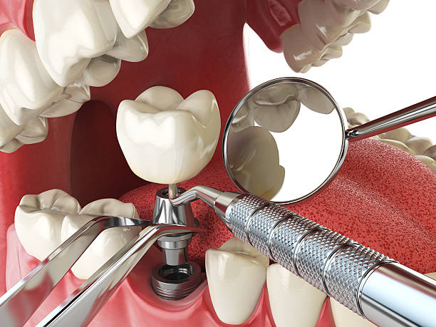 Best Emergency Tooth Extraction in New Wilmington, PA